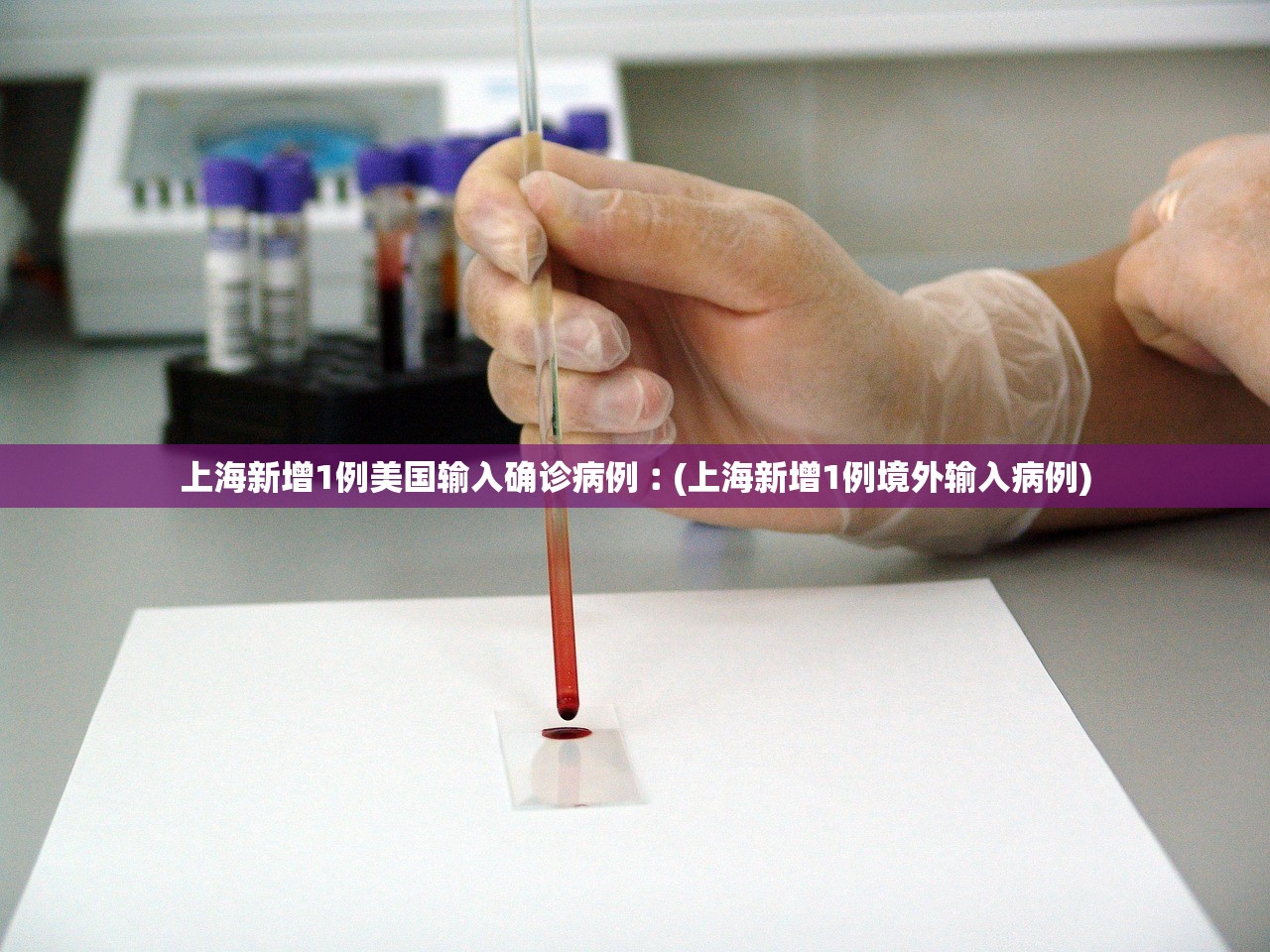 上海新增1例美国输入确诊病例︰(上海新增1例境外输入病例)
