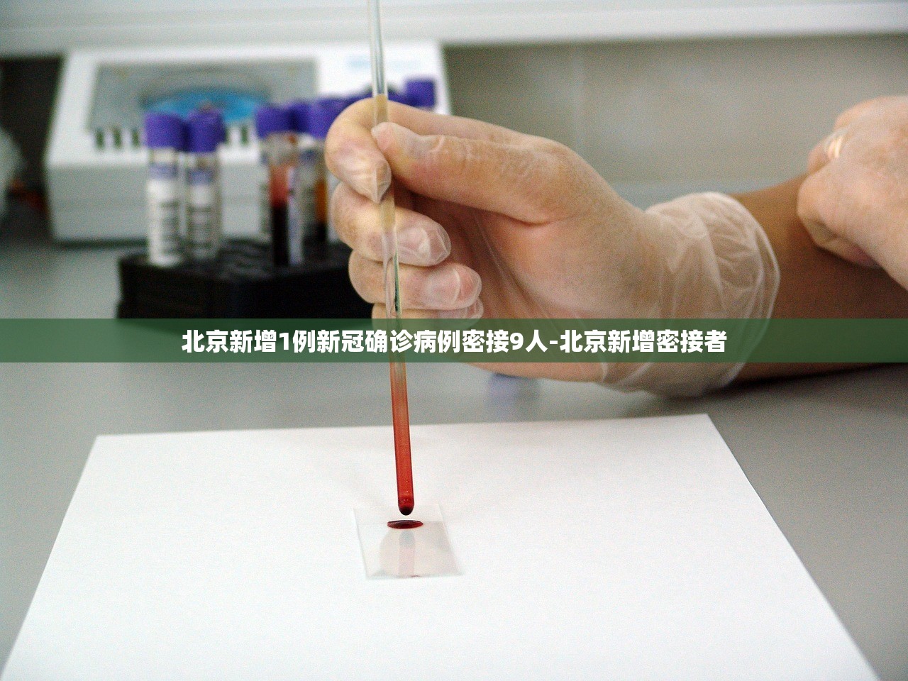 北京新增1例新冠确诊病例密接9人-北京新增密接者