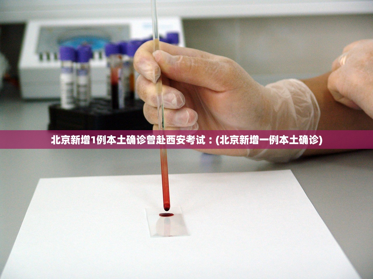 北京新增1例本土确诊曾赴西安考试︰(北京新增一例本土确诊)