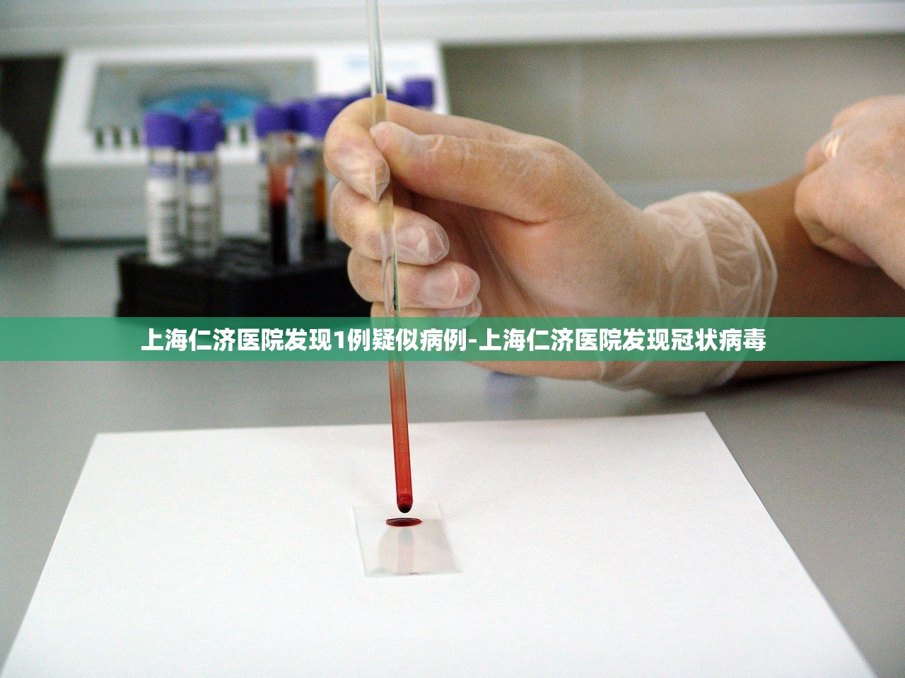 上海仁济医院发现1例疑似病例-上海仁济医院发现冠状病毒