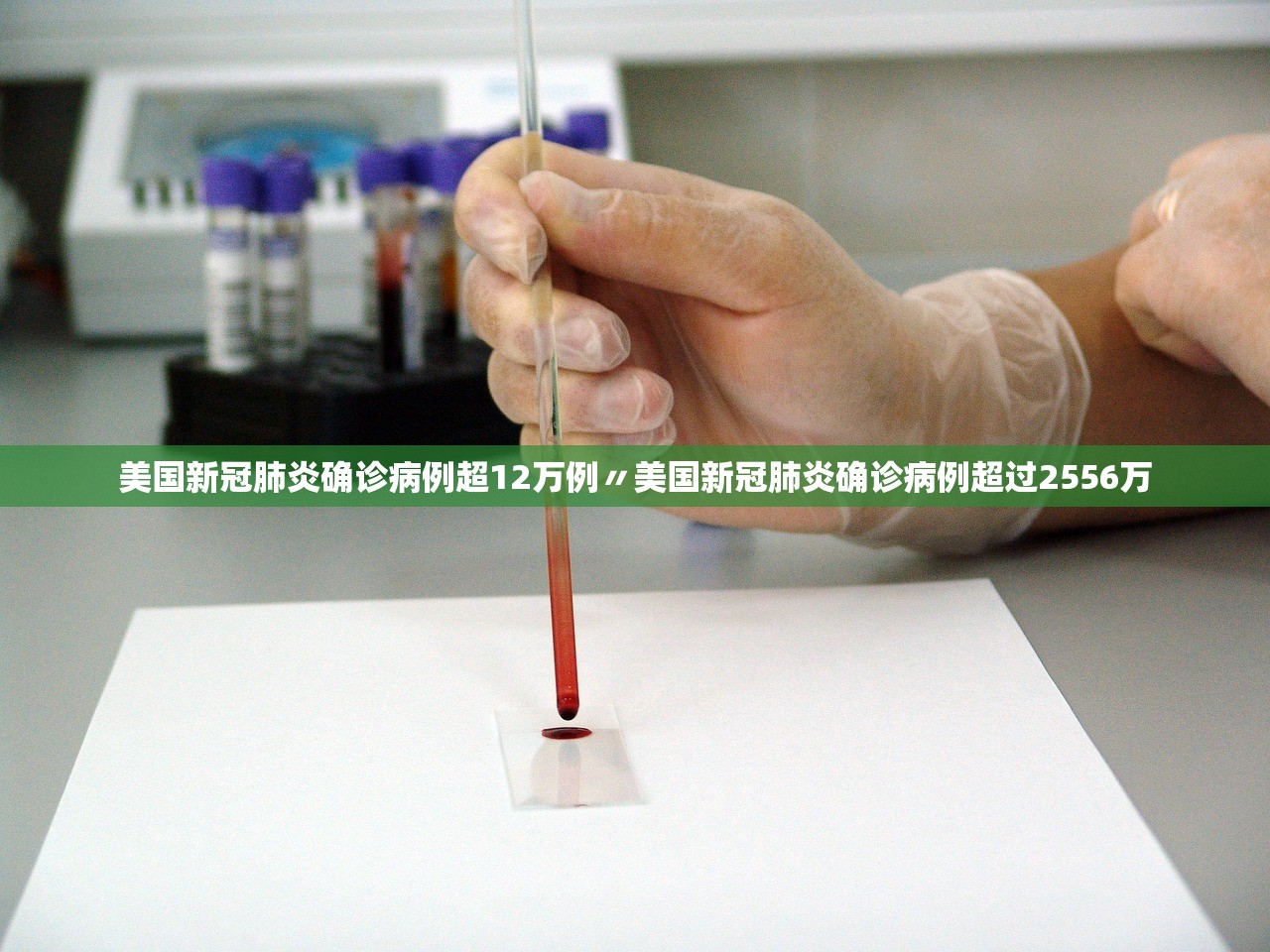 美国新冠肺炎确诊病例超12万例〃美国新冠肺炎确诊病例超过2556万