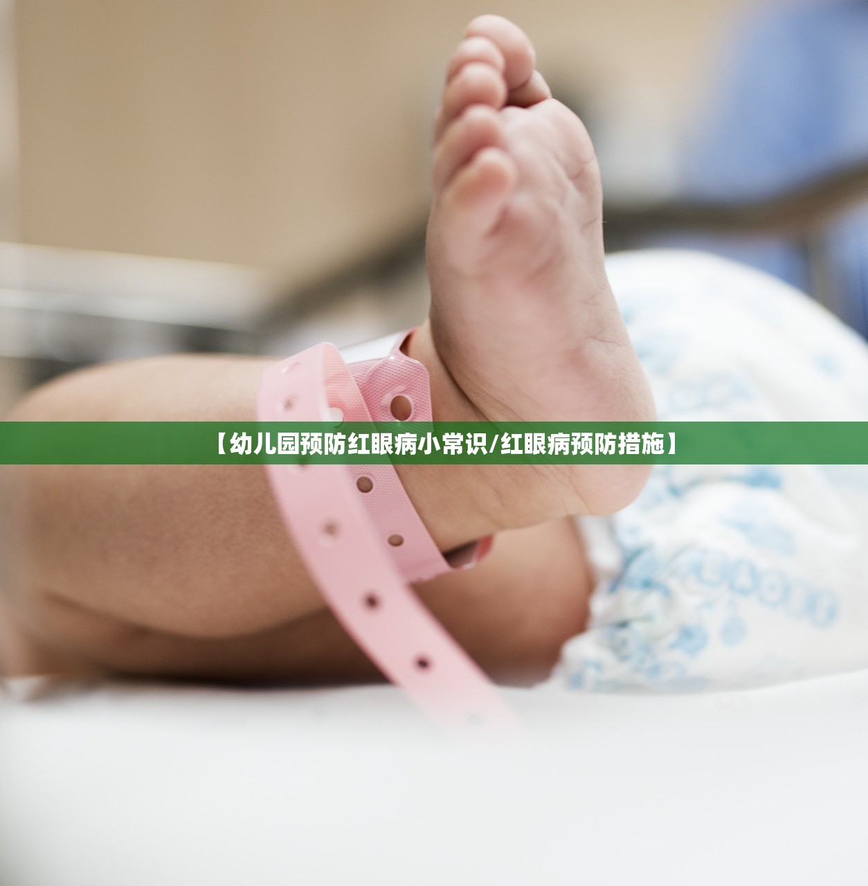 【幼儿园预防红眼病小常识/红眼病预防措施】 【幼儿园预防红眼病小常识/红眼病预防措施】