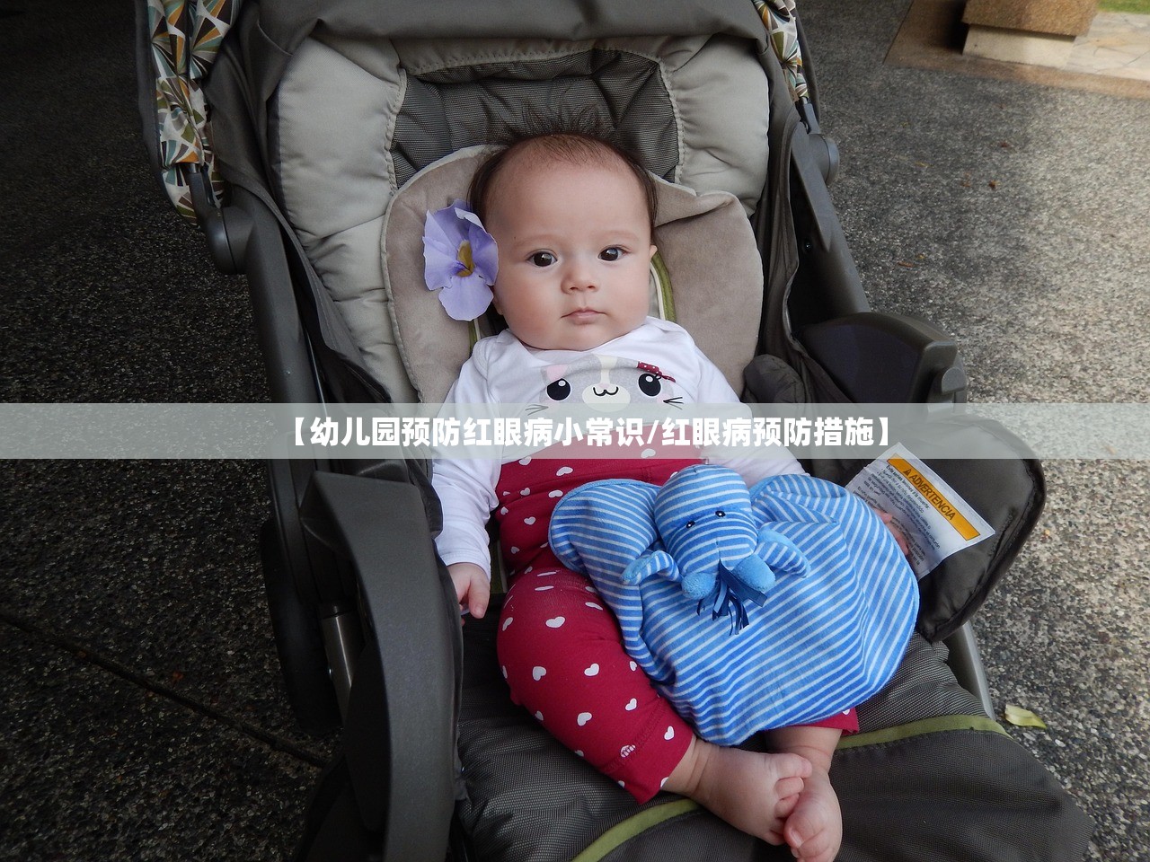 【幼儿园预防红眼病小常识/红眼病预防措施】 【幼儿园预防红眼病小常识/红眼病预防措施】